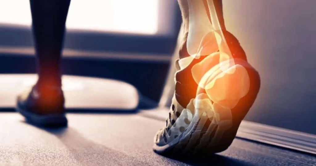 Can Insoles Help Alleviate Back Pain