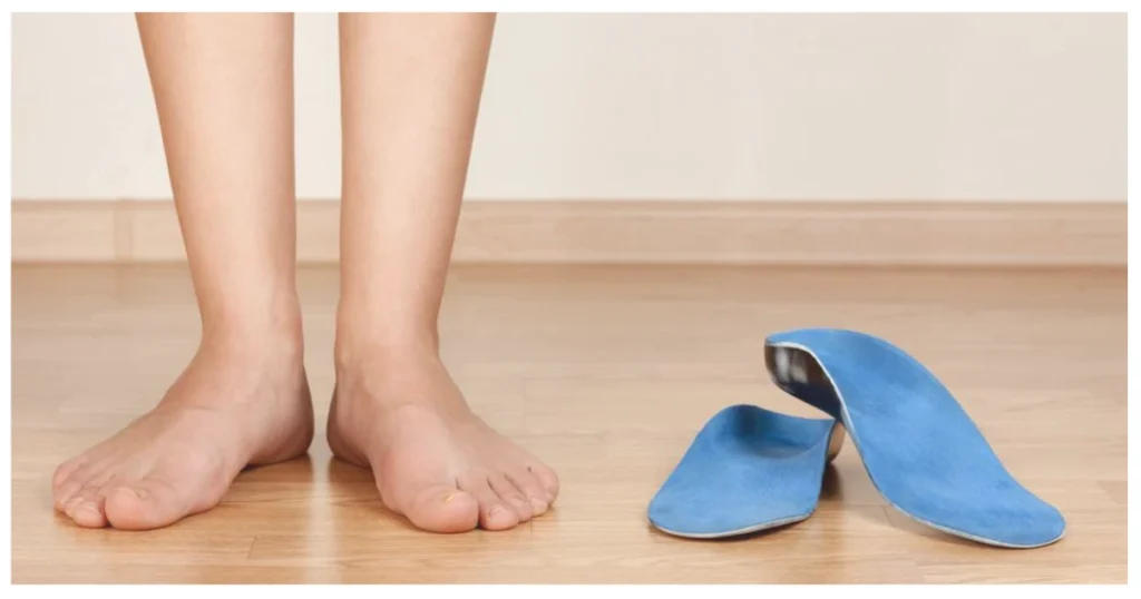 Do Insoles Really Help Flat Feet Benefits, Limitations & Expert Tips
